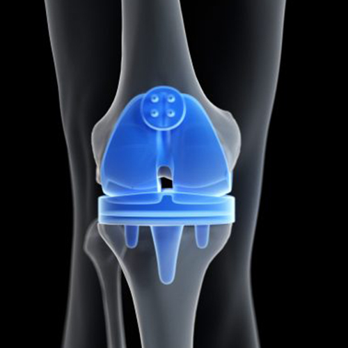expert-robotic-knee-surgeon-pune