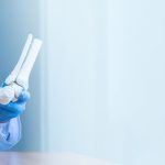 Total Hip Replacement