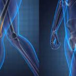 Total Hip Replacement